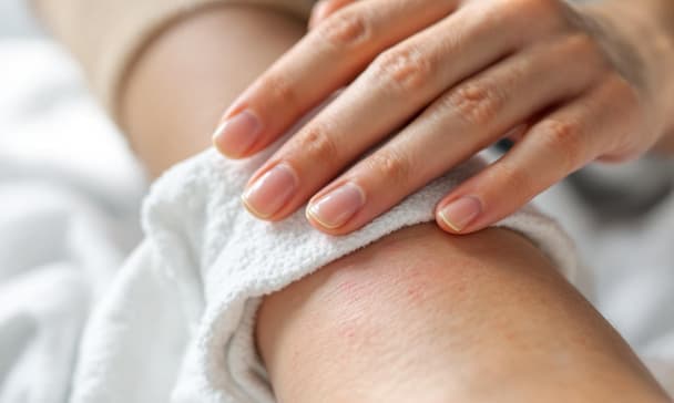 蚊子叮咬紅腫不消怎麼辦？常見處理方式與止癢資訊整理