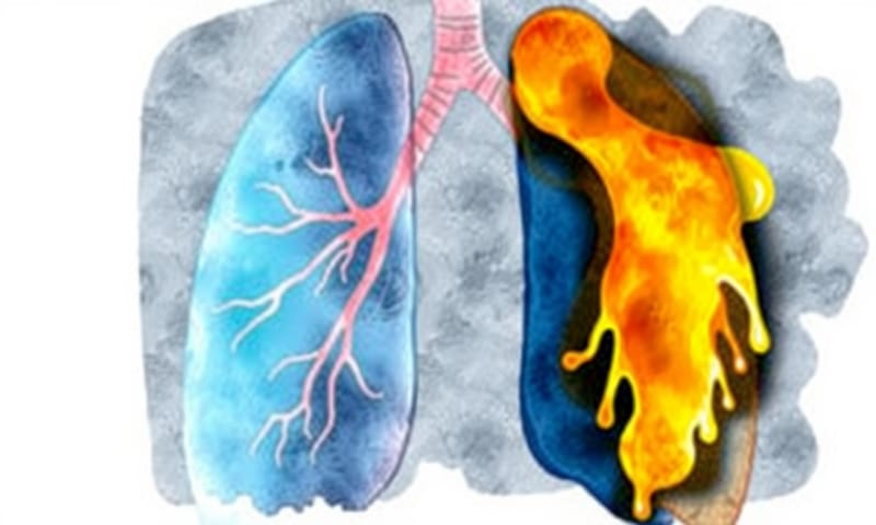 健康的肺（左）與發生EVALI的肺（右）對比，這真的不是開玩笑的。