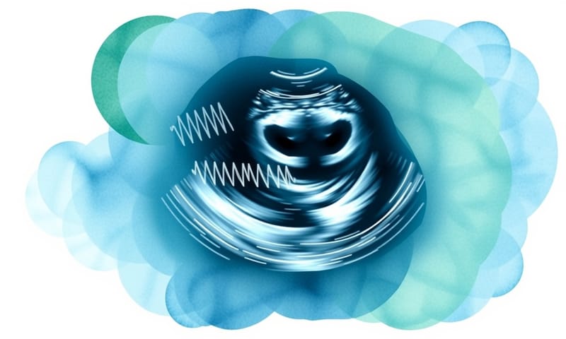 以抽象藝術風格呈現乳房超音波的檢查概念